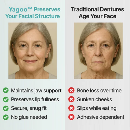 🔥BLACK FRIDAY SALE-🏆Ends Today: 70% OFF! Yagoo™ Custom Custom-Fit Full Functional Dentures
