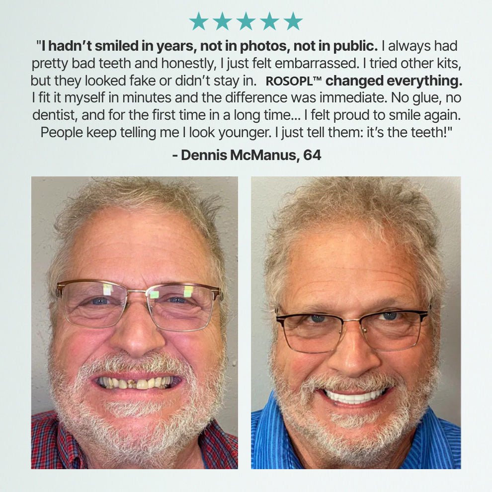 🌎Ends Today: 70% OFF! Custom-Fit Full Functional DenturesMake you more confident