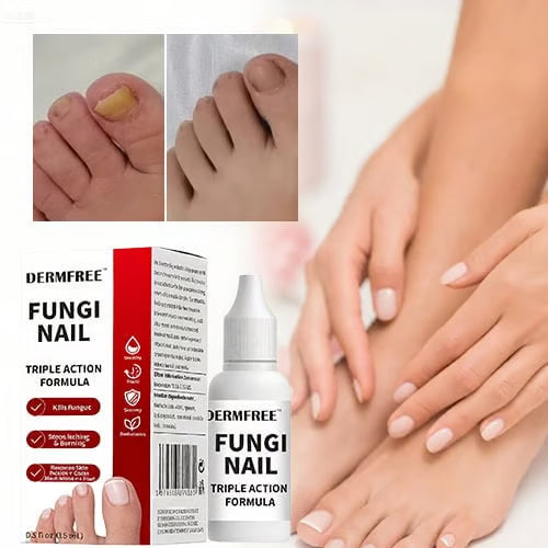 Toenail Fungus Treatment Extra Strengthr