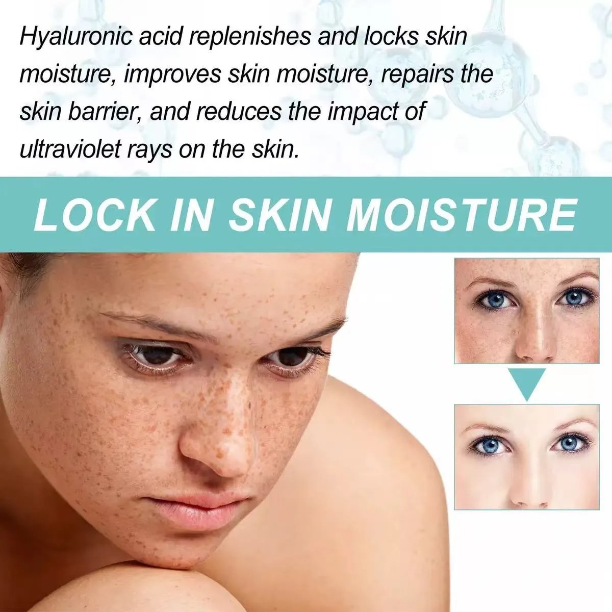 Dark Spot Corrector-Special Cream For Melasma Treatment