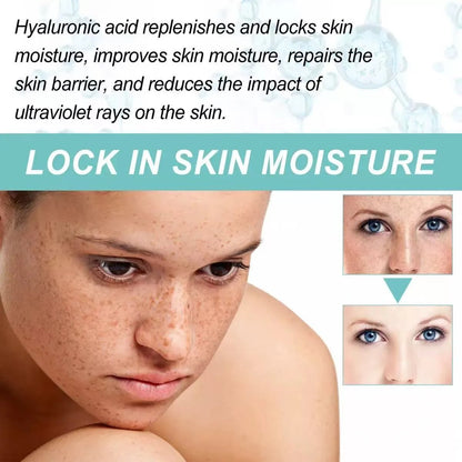 Dark Spot Corrector-Special Cream For Melasma Treatment