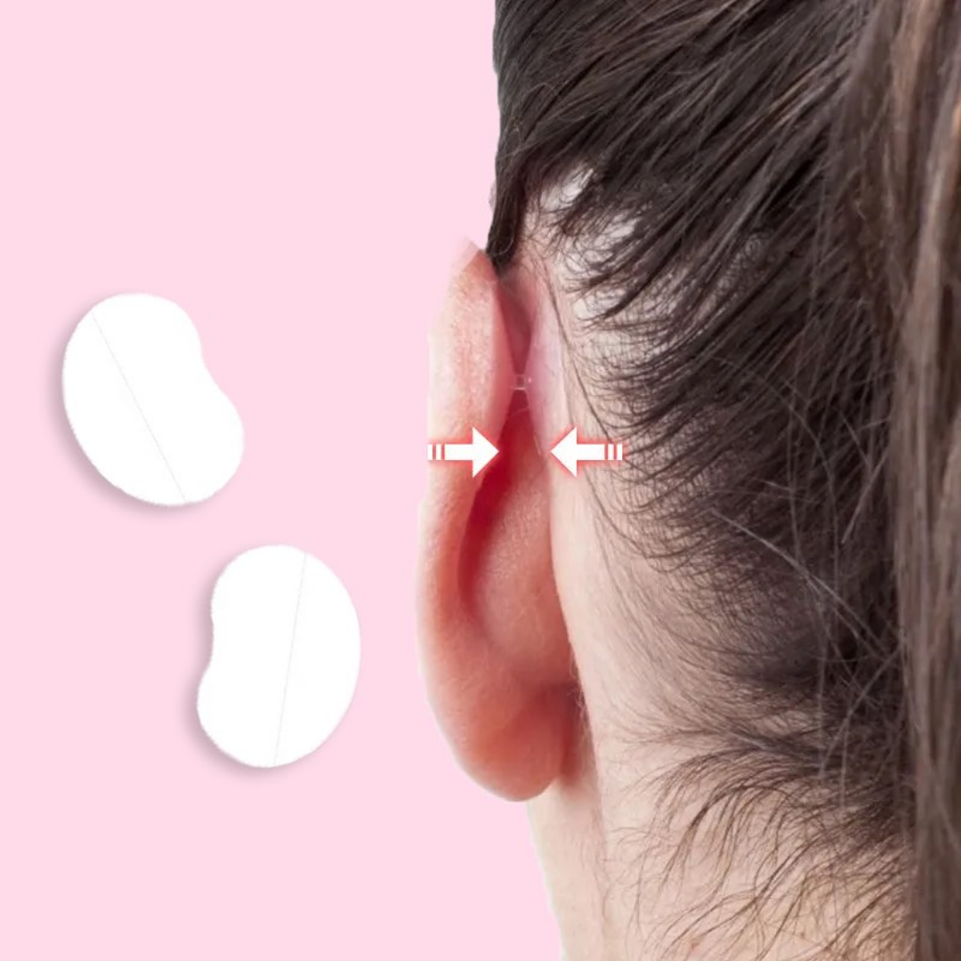 EarAlign™ - Komfortable Ohrformungspflaster