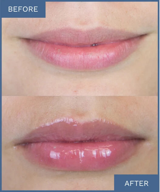 This hydrating, high-shine lip gloss provides long-lasting moisture and is resistant to fading
