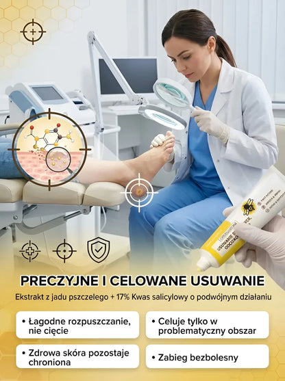 Bee venom cream for removing calluses and corns