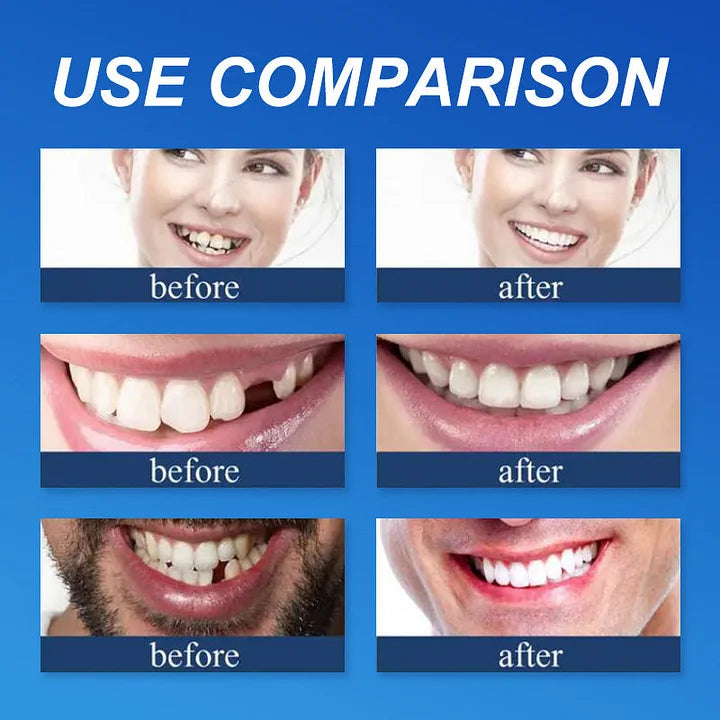 🔥Ends Today: 75% OFF! ⏰DarkFairy™ Medical Full Denture with Strong Suctiond Custom-Fit Full Functional Dentures🦷
