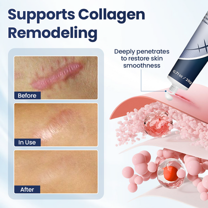 🔥Last Day Discount🔥 Nexisify® DERMALUX Texture Repair Gel