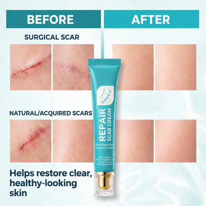 Scar Repair Cream