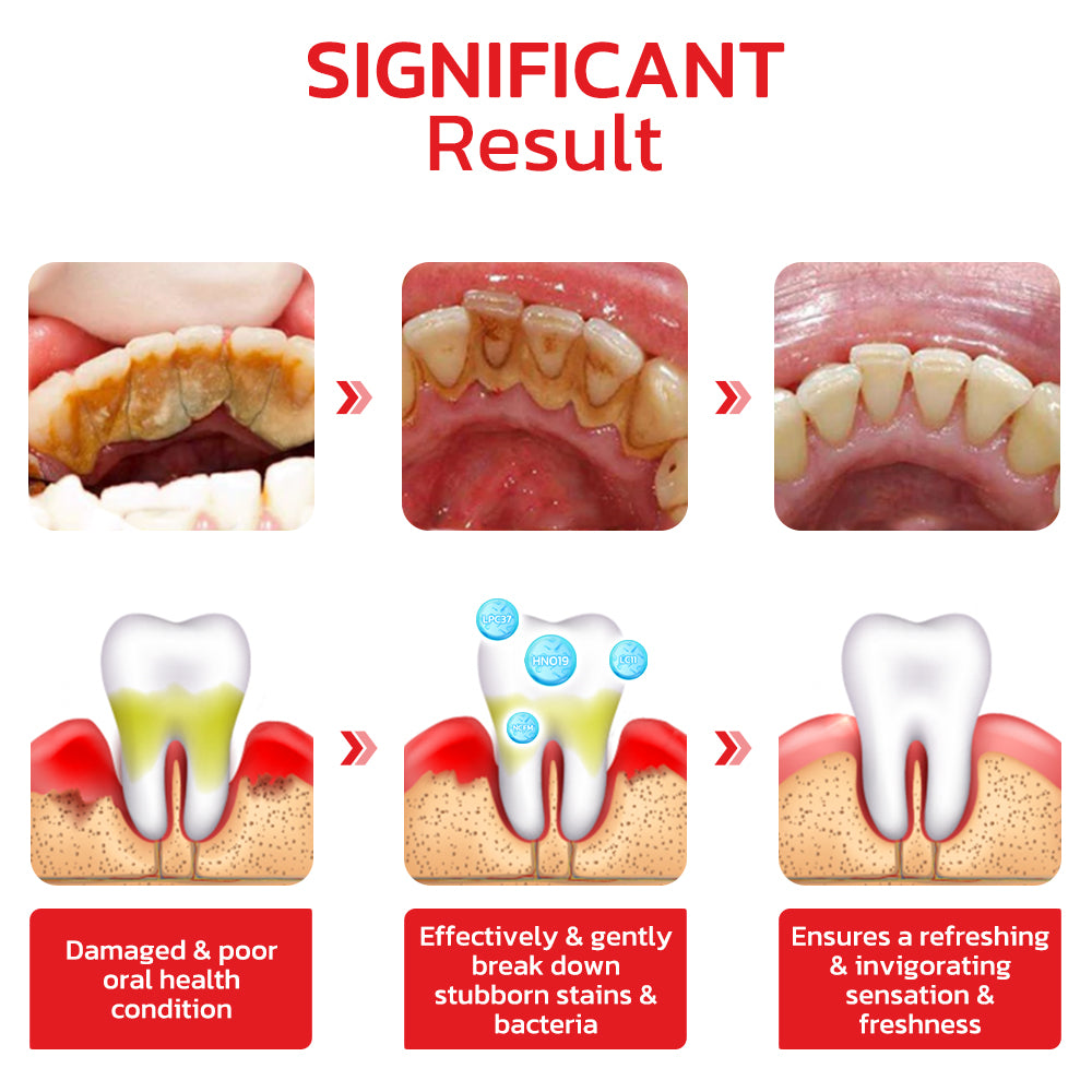 SP4 Probiotic Whitening Toothpaste
