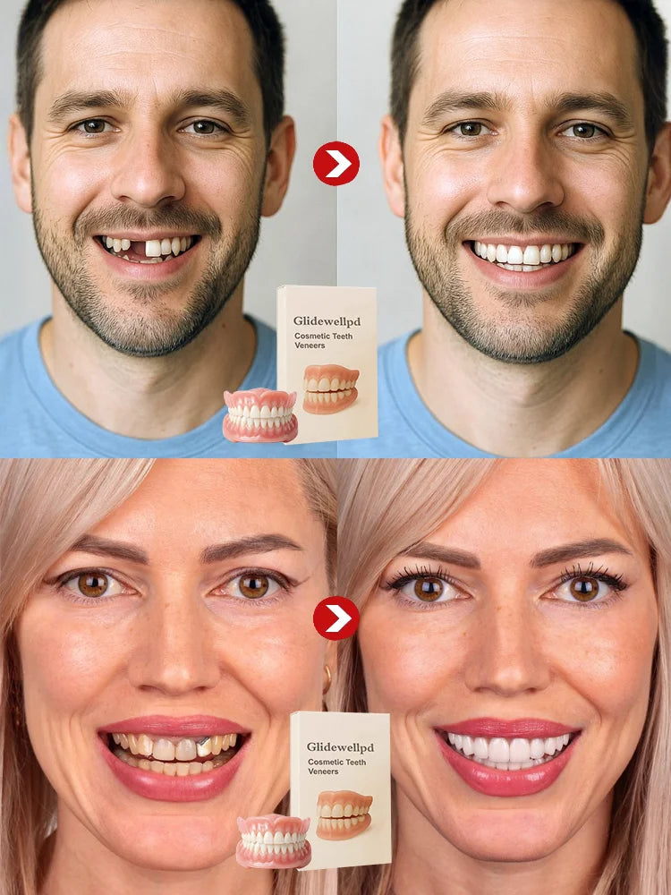 [Epic Upgrade] Premium Full Cover Dentures