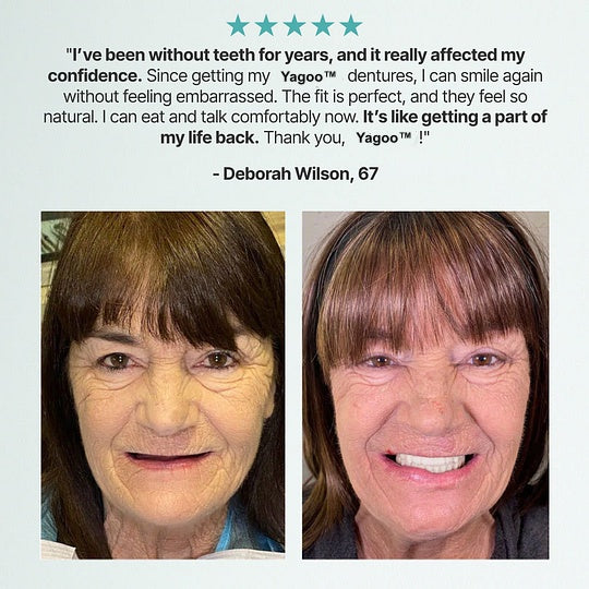 🔥BLACK FRIDAY SALE-🏆Ends Today: 70% OFF! Yagoo™ Custom Custom-Fit Full Functional Dentures