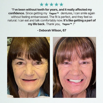 🔥BLACK FRIDAY SALE-🏆Ends Today: 70% OFF! Yagoo™ Custom Custom-Fit Full Functional Dentures