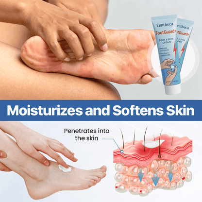 FootGuard+ | Diabetes Treatment Cream
