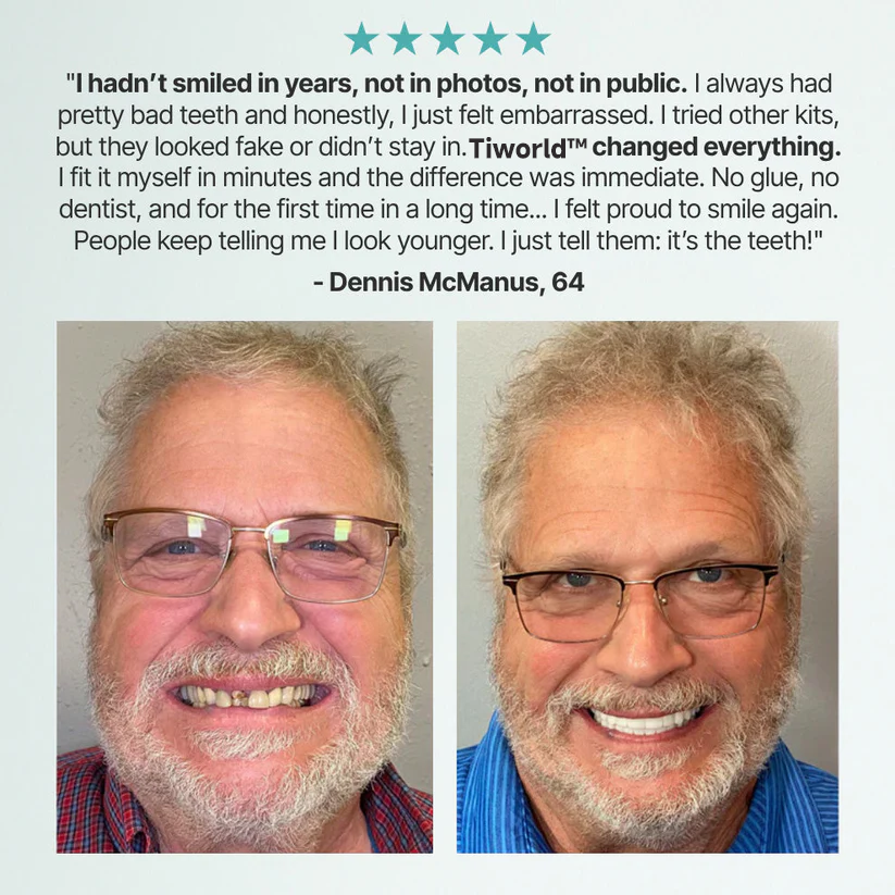 ✨Ends Today: 70% OFF! Tiworld™⏰ Custom-Fit Full Functional Dentures Make you more confident