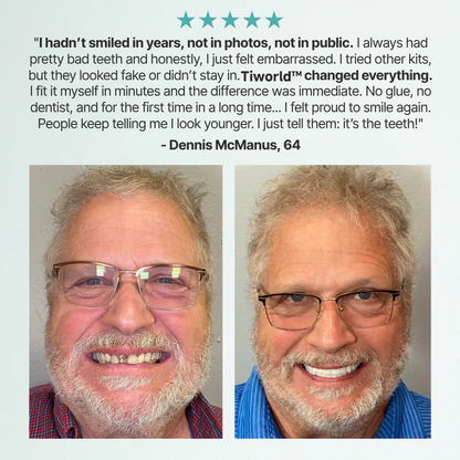 ✨Ends Today: 70% OFF! Tiworld™⏰ Custom-Fit Full Functional Dentures Make you more confident